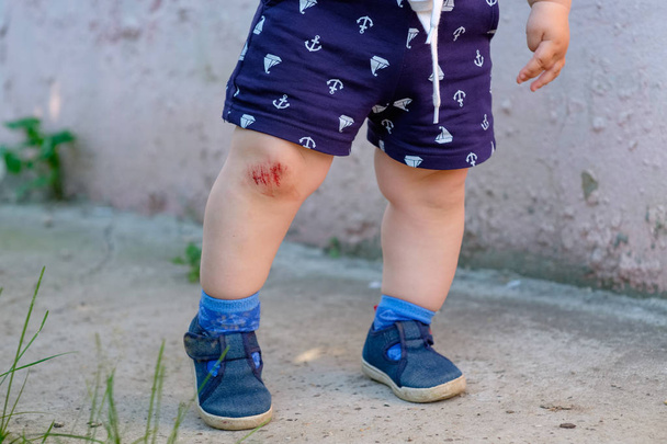 küçük bir Avrupa çocuk asfalt üzerinde düşen bir sonucu olarak onun diz üzerinde kan aşınma - Fotoğraf, Görsel