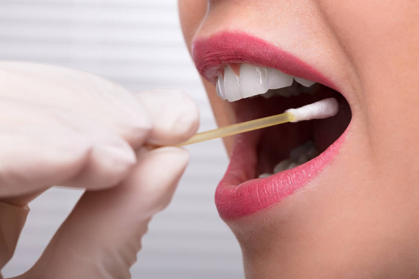 Dentist's Hand Taking Saliva Test From Woman's Mouth With Cotton Swab - Foto, imagen