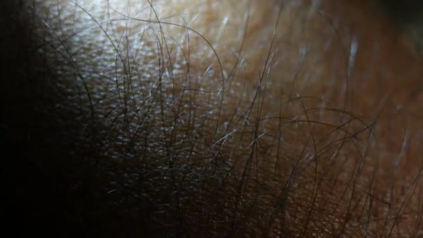 Textura de la piel herida cerca de imágenes
  - Metraje, vídeo