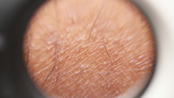 Close up of a hairy skin - Footage, Video