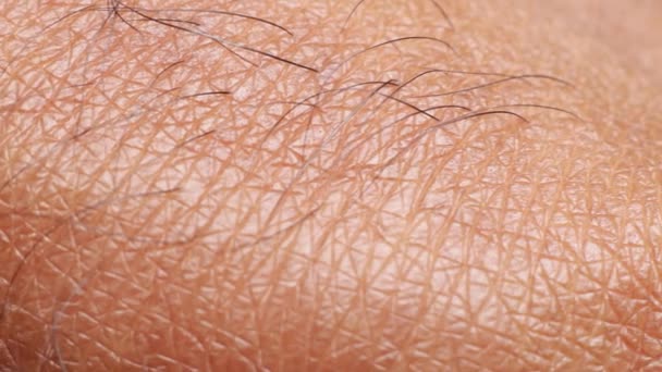 El primer plano de la piel peluda
 - Imágenes, Vídeo