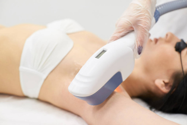 Medical procedure. Laser hair removal. Removing underarm hair. Bright skin. - Photo, Image