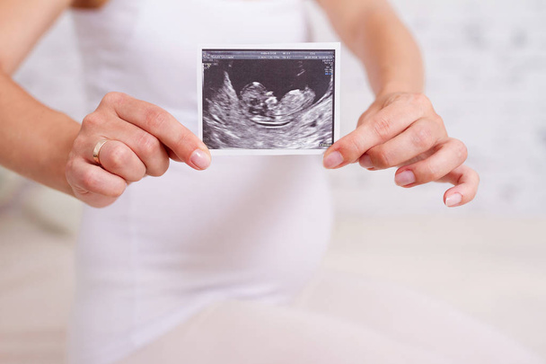 Pregnant woman holding ultrasound scan, closeup - Photo, Image