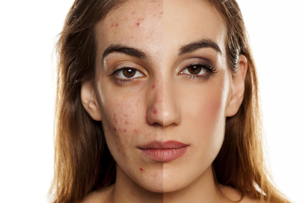 Retrato de comparação da mesma mulher antes e depois do tratamento cosmético e maquiagem em fundo branco
 - Foto, Imagem