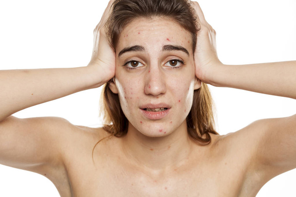 Jeune femme malheureuse avec la peau problématique et sans maquillage posant sur un fond blanc
 - Photo, image