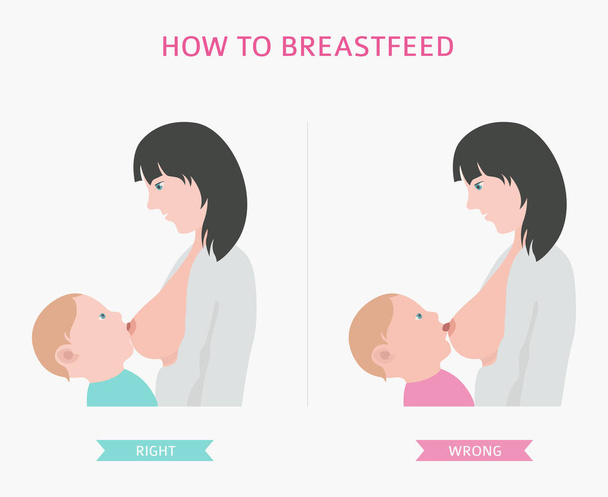 Mastitis, breastfeed, medical infographic. Diagnostics, symptoms, treatment. Women`s health icon set. Vector illustration - Vector, Image