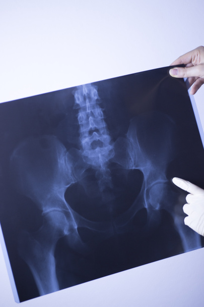 Raio-X hospitalar médico dor nas costas coluna vertebral e quadris traumatologia digitalização
. - Foto, Imagem