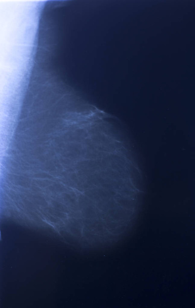 Mamografía de hospital médico radiografía mamografía de cáncer de mama
. - Foto, Imagen
