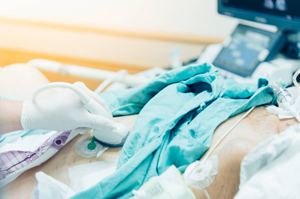 患者アジア高齢者女性 80 病院の集中治療室 (Icu.) 部屋で患者のベッドの上の高齢者患者の腹部に超音波装置を使用しての医者によって診断のための腹部のスキャンを行う. - 写真・画像