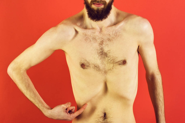 dystrophy. bearded man or hipster with slim body, with anorexia - Photo, Image