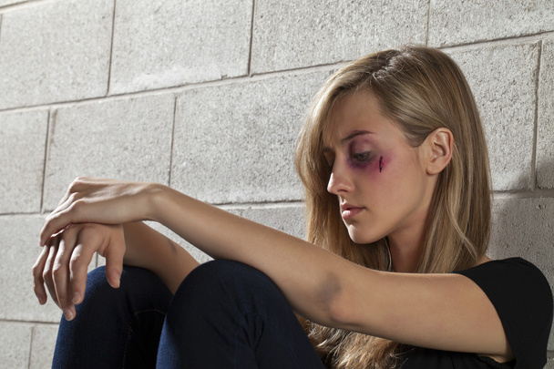 uma mulher agredida com hematomas
 - Foto, Imagem