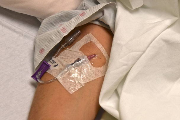 Un patient couché dans un lit relié à un port a reçu des médicaments et des liquides.
. - Photo, image