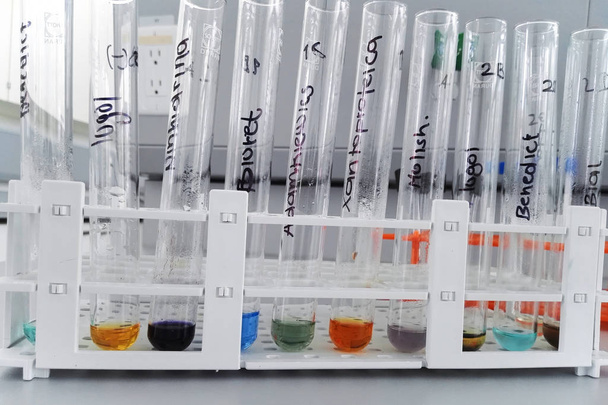 Test de laboratoire pour la détermination des glucides et des protéines : lugol, biuret, xanthoprotéique, molish, ninhydrine, benedict, bial, adamkiewics
 - Photo, image