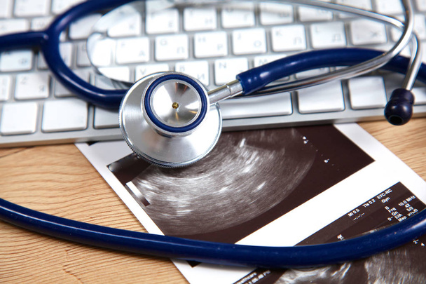 ein medizinisches Stethoskop neben einem Laptop auf einem Holztisch - Foto, Bild