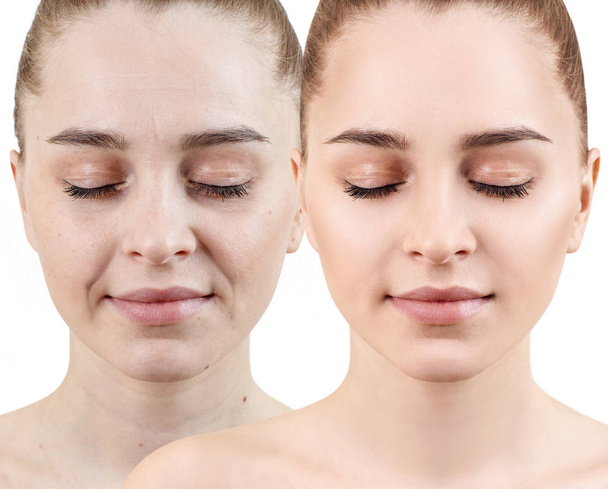 Femme visage avant et après rajeunissement
. - Photo, image