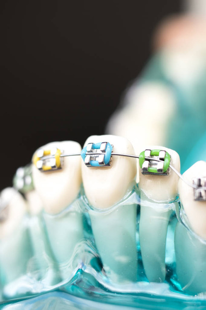 Los apoyos metálicos dentales dientes retenedor alineadores enseñanza ortodoncia modelo
. - Foto, Imagen