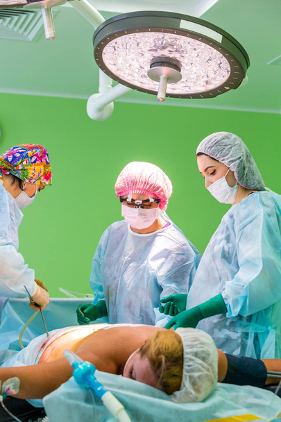 cirugía de liposucción cosmética en quirófano real, grupo de cirujanos que trabajan con cánula
 - Foto, imagen