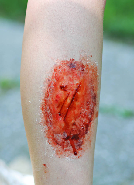 Maquillaje herida y sustos en las mujeres de la pierna
 - Foto, imagen