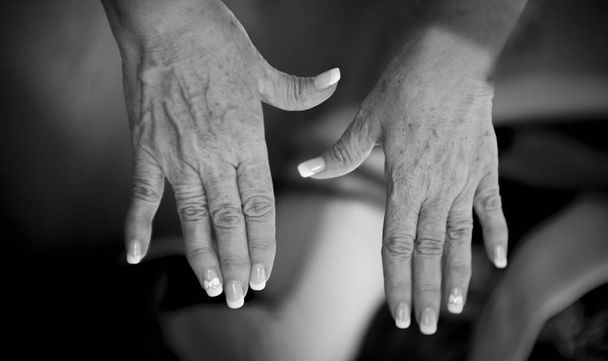 Τα χέρια της μια γυναίκα μέσης ηλικίας με προβλήματα των ρευματισμών, της οστεοαρθρίτιδας και δέρμα κηλίδες - Φωτογραφία, εικόνα