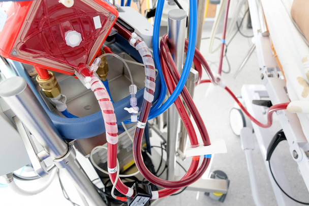 máquina de trabajo ecmo en el departamento de cuidados intensivos
 - Foto, Imagen