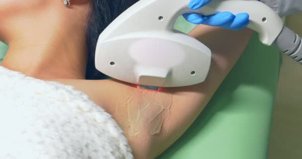 Hair removal at cosmetic beauty clinic. Cosmetologist do laser epilation - Footage, Video