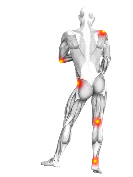 Fogalmi emberi izom anatómia, piros és sárga hot spot gyulladás vagy egészségügyi kezelés vagy sport fogalmak izületi ízületi fájdalom. 3D-s illusztráció az ember arthritis vagy csont csontritkulás betegség - Fotó, kép