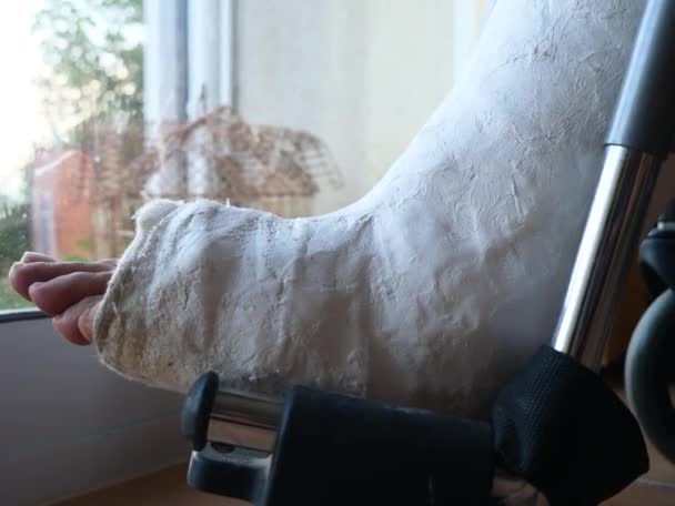 Patient mit Beinbruch im Krankenhaus  - Filmmaterial, Video