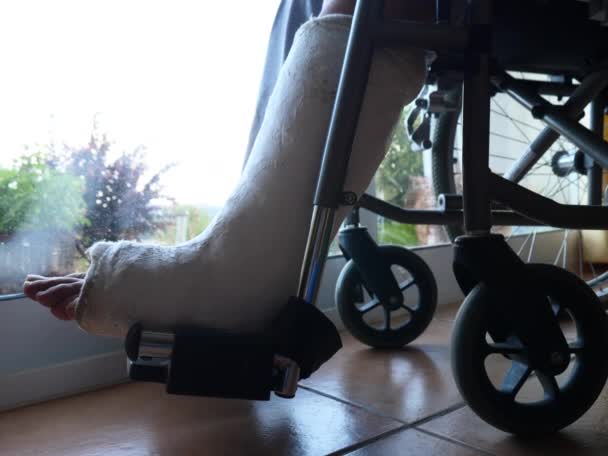 Patient mit Beinbruch im Krankenhaus  - Filmmaterial, Video