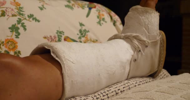 leg in a plaster cast of female patient - Footage, Video