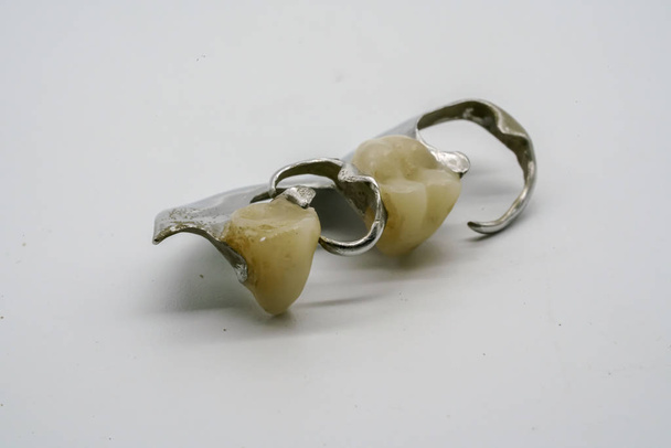 Χρώμιο κινητή μερική οδοντοστοιχία που απομονώνονται σε λευκό φόντο. - Φωτογραφία, εικόνα