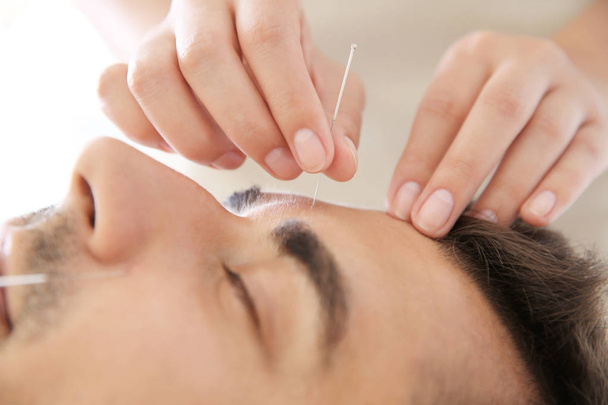 Young man undergoing acupuncture treatment in salon, closeup - Фото, изображение