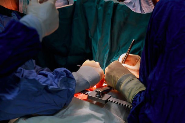 Doktor dělá operace srdce zásobování srdce dárce pro transplantaci srdce - Fotografie, Obrázek