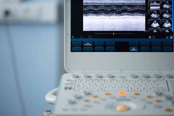 On the screen of the ultrasound apparatus, the scan of the left ventricle of the heart in the position for measuring the ejection fraction by Teyolz. - Zdjęcie, obraz
