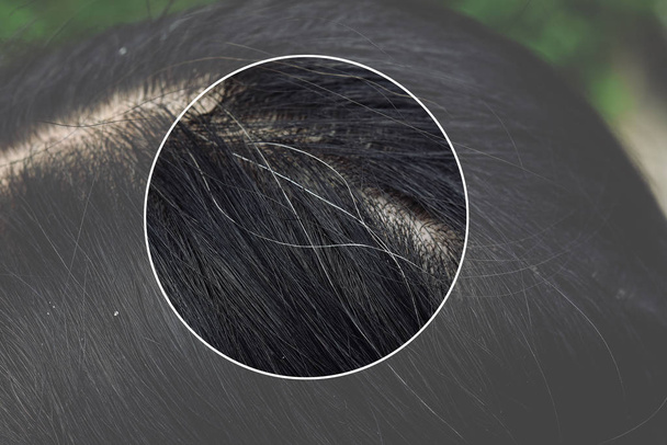 Problemas de salud del cabello y el cuero cabelludo, Joven mujer asiática con el primer pelo gris, Edad Media mujer problemas de envejecimiento. - Foto, Imagen