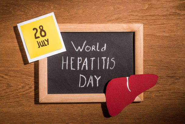 Draufsicht auf Tafel mit Schriftzug Welt-Hepatitis-Tag, Leber und Aufkleber mit Schriftzug 28. Juli auf Tisch - Foto, Bild
