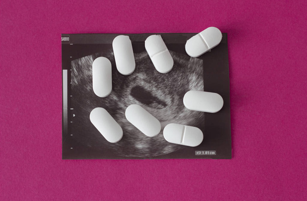 Uzi of pregnancy on a pink background and pills, abortion. - Photo, image