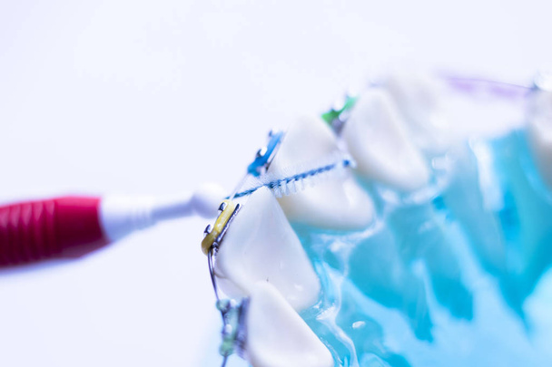 Inter οδοντιατρική δόντια βούρτσα υγιή νήμα δράση ανάμεσα σε κάθε δόντι με τιράντες ευθυγραμμιστές καθαρισμού. - Φωτογραφία, εικόνα