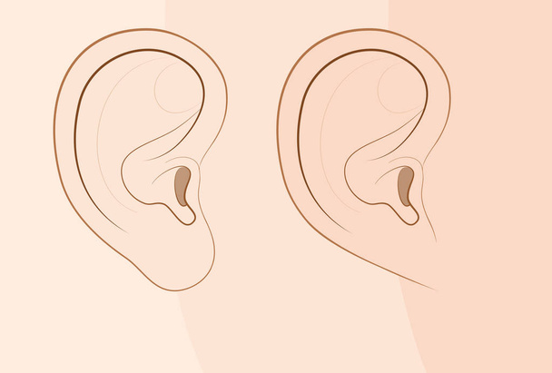 Συνημμένη earlobe και δωρεάν earlobe σε σύγκριση. Διαφορετικό κοιτάζει το ανθρώπινο αυτί λόγω υπολειπόμενο γονίδιο συχνότητα. Εικονογράφηση Κόμικ φορέα. - Διάνυσμα, εικόνα