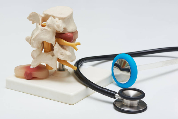 Zijaanzicht van kunstmatige menselijke lumbale wervelkolom model en hernia. op witte achtergrond een blauwe stethoscoop en een reflex hamer op tafel in medische kantoor.   - Foto, afbeelding