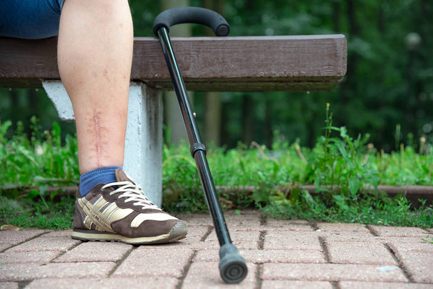 Pierna asustada de discapacitado en el banco con un bastón en el parque
 - Foto, imagen