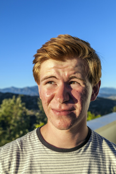 portrait of handsome boy with red hair under blue sky - Photo, Image