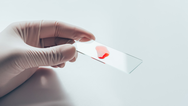 cropped shot of doctor in white glove holding glass slide with blood Sample - Zdjęcie, obraz