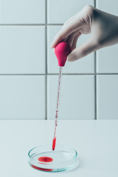 petri kabına pipet Doktor dökülen kanı atış kırpılmış - Fotoğraf, Görsel