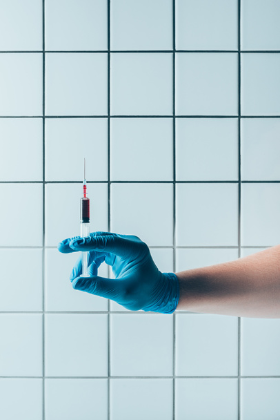 Schnappschuss von Arzt in Handschuh mit Blutspritze vor gekachelter weißer Wand - Foto, Bild