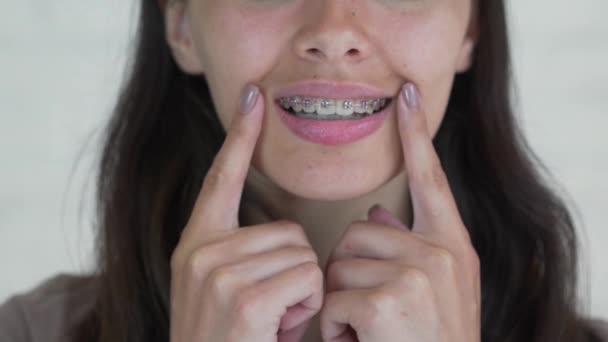 Mladá dívka s rovnátka na zuby při pohledu na fotoaparát a usmívá se. Detailní záběr. - Záběry, video