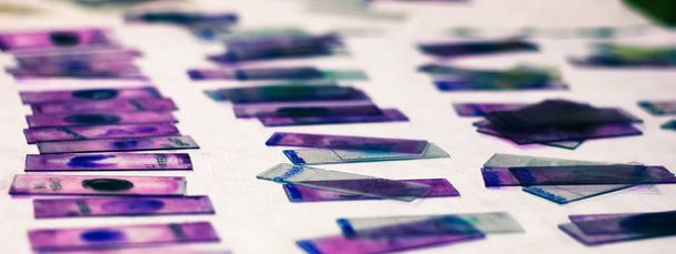 Gebrandschilderd glas dia's van perifeer bloeduitstrijkje met violette Leishman Giemsa vlek in hematologie pathologie laboratorium - Foto, afbeelding
