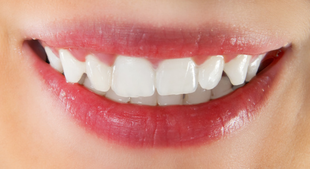 fehér egészséges fogak - Fotó, kép