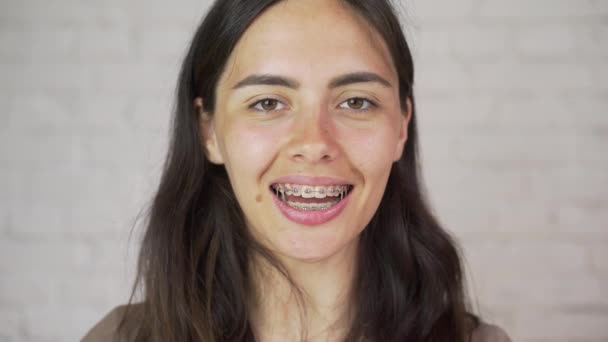 people, expression and emotion concept - happy smiling young woman with braces - Filmmaterial, Video