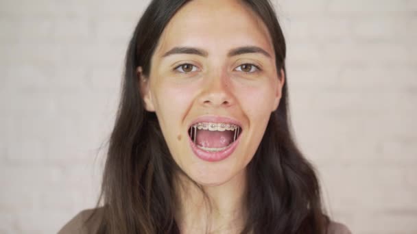 people, expression and emotion concept - happy smiling young woman with braces - Materiał filmowy, wideo