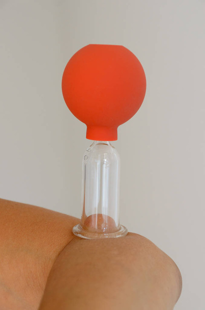 Acercamiento en el dispositivo de terapia de bombilla de ventosa roja y transparente unido al codo frente al fondo blanco
 - Foto, Imagen